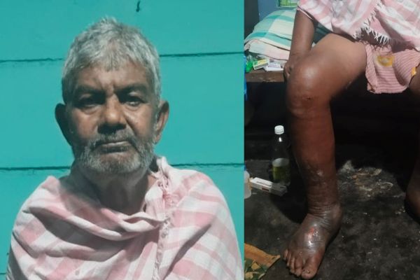 ఏటికొప్పాక గ్రామపంచాయతీ – పారిశుద్ధ్య కార్మికుడి ఆవేదన !